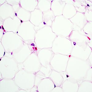 Human Adipocytes